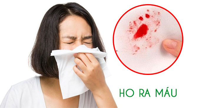 Mơ thấy ho ra máu – điềm báo lành hay dữ?